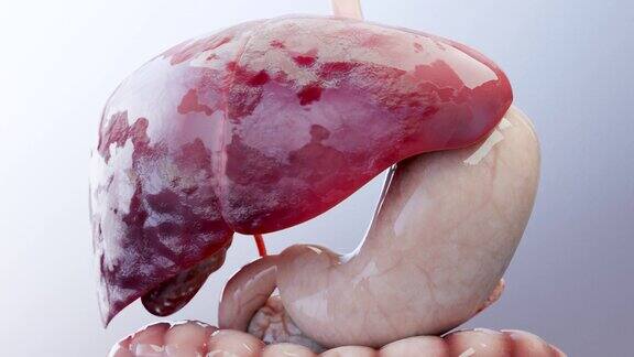 消化器官肝癌肝炎肝硬化恶性肿瘤肝功能衰竭生长细胞复制纤维化肝硬化肝细胞癌病毒感染肝脏人类3d渲染