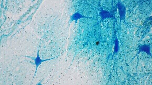 运动神经元全片置于亮场背景下100倍放大显微镜下