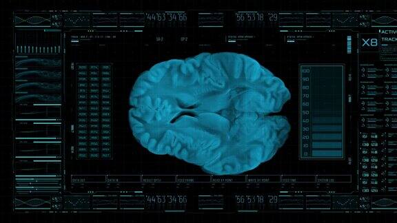 神经内科用高科技屏幕以3D形式显示大脑并通过统计数据监测其生命体征
