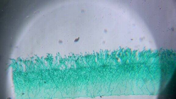 青霉菌在显微镜