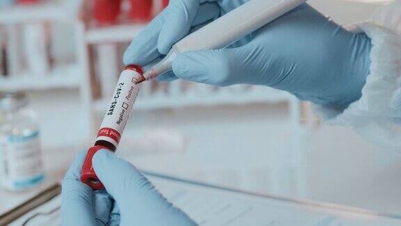 医生手持SARS-CoV-2血液检测阳性的试管的特写