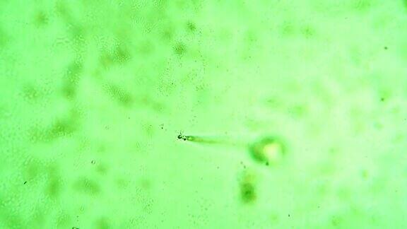 在有颜色的水中集中观察单个滴虫漩涡菌的茎