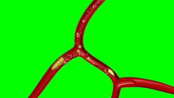 3d血细胞胆固醇凝块医疗设计在绿色屏幕4k