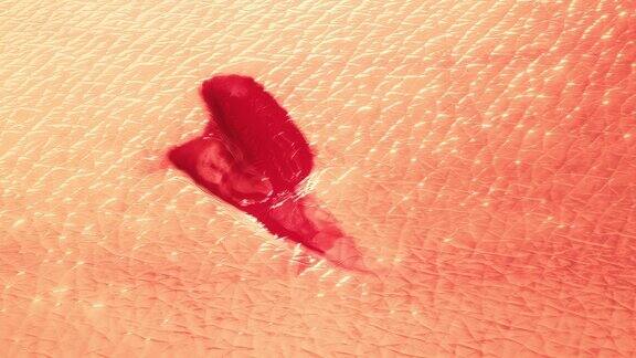 愈合伤口再生流血的伤口消失了皮肤形成了新的纹理