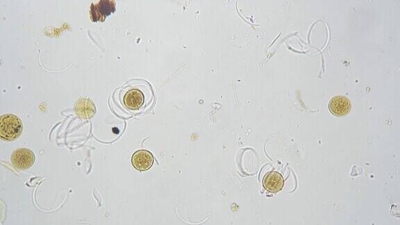木贼孢子在光面100倍显微镜下全挂
