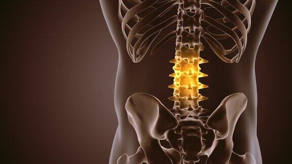 背部疼痛的医学背景