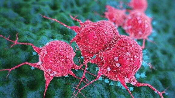 癌症细胞