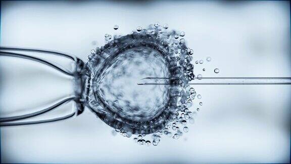 胞浆内精子注射体外受精