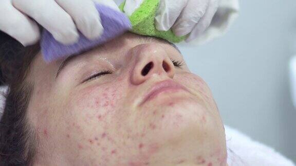 年轻女子在她的脸上用特殊凝胶进行面部治疗在美容水疗中心进行痤疮问题皮肤治疗
