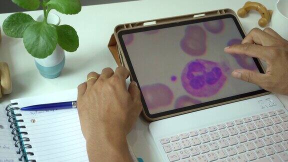 亚洲男性通过数码平板看血球白血病细胞了解自己白血病的阶段