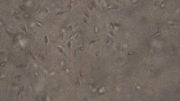 在显微镜下观察的精子在相衬显微镜下移动精子中等放大