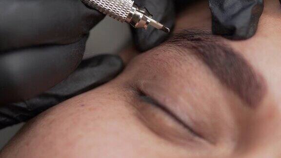 在一个男人的眉毛上进行微型刀片手术的特写