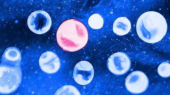 球体气泡就像变异的细胞在显微镜背景下形成病变细胞