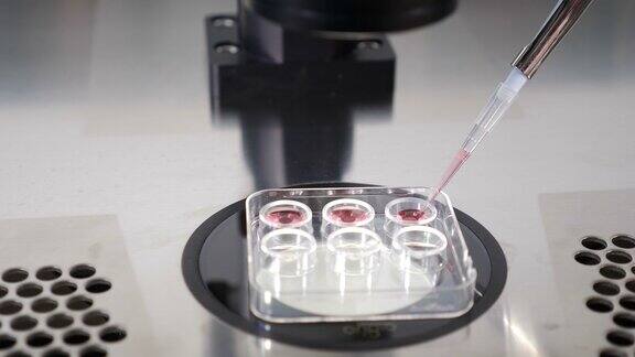 精细的实验室操作将胚胎从低温保护剂转移到专门的医疗工具以便随后冷冻专家使用移液管取胚4k的视频