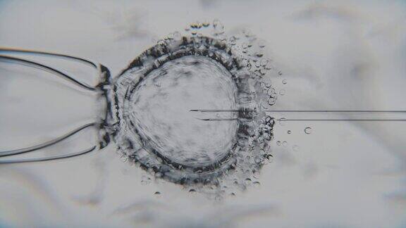 胞浆内精子注射体外受精