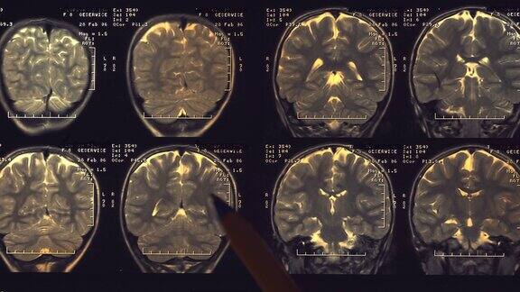 人脑的核磁共振成像(mri)特写镜头宏