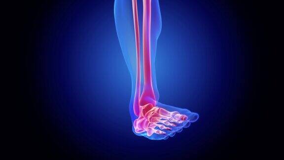脚踝扭伤-骨骼x光片