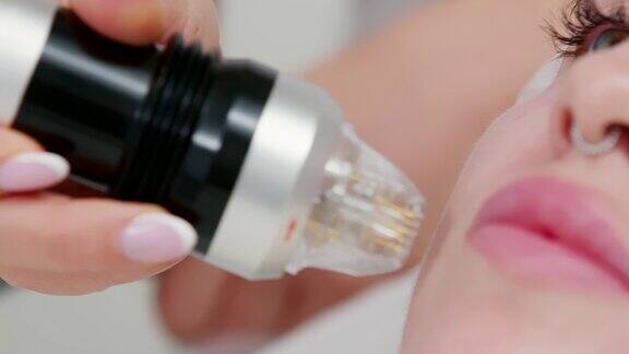 分式微针射频提升术在美容诊所的应用硬件美容关闭了美容师做面部年轻化治疗护肤抗衰老概念美容师4k视频