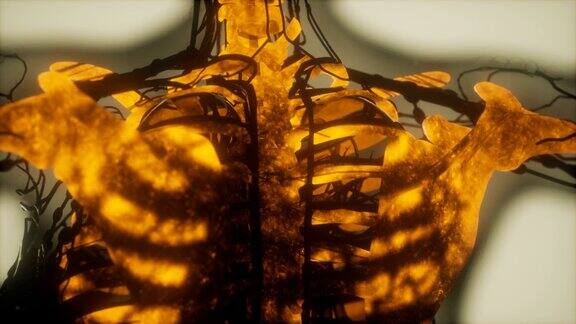 人体骨骼扫描时会发光