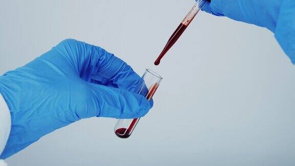 医生用移液管将血液滴入一个小试管中