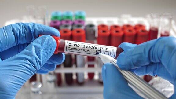 阴性冠状病毒血液检测概念试管冠状病毒阴性血在实验室桌子上医学