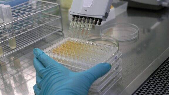实验室里检查抗生素的培养皿的特写镜头