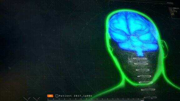 医学软件监测患者的大脑活动屏幕上显示核磁共振测试结果