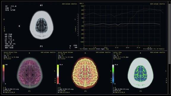 用医疗设备扫描病人脑部以诊断癌症