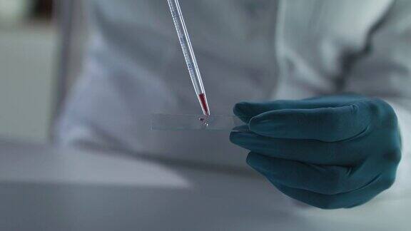 用移液管将一滴血滴在显微镜载玻片上