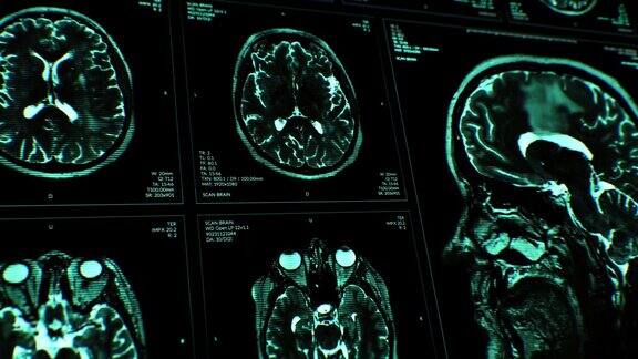 脑部核磁共振成像扫描蓝色的医学背景x射线心电图