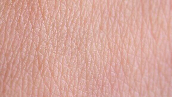 人类皮肤