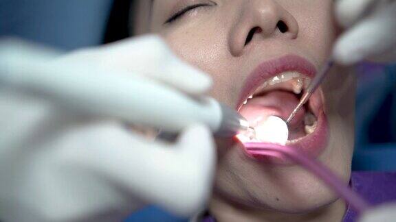 医生用探测仪探测牙齿寻找蛀牙治疗牙科助理协助医生在治疗过程中使用吸力保持患者口腔干燥