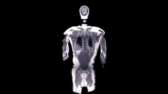 MRI全身扫描MRI扫描仪冠状面
