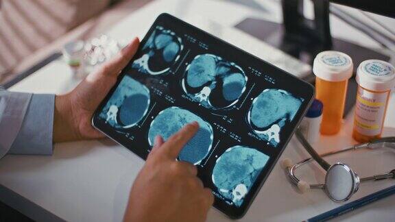 医生在数码平板电脑上看X光片