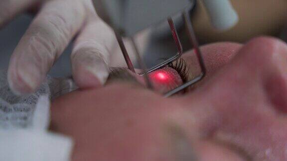 美容师用激光技术进行分体式微针疗法为客户在诊所美容院进行硬件美容