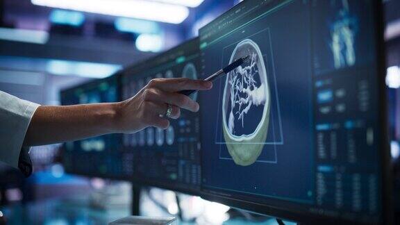现代癌症研究医学中心:匿名医生指着桌面电脑显示器用3D软件显示基于CT扫描的人脑神经科医生在病人大脑中寻找肿瘤
