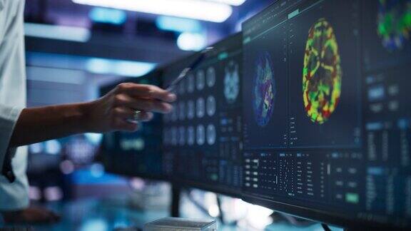 现代医学研究中心:匿名医生用软件指着桌面电脑显示器显示基于核磁共振扫描的人脑神经学家在寻找脑损伤的影响区域