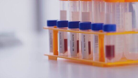 实验室架子上装有血型样本的试管的特写