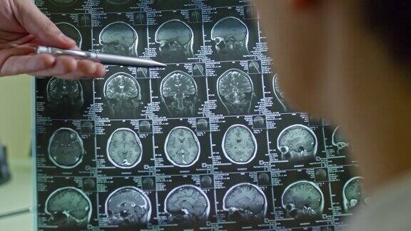 医生解释脑部CT扫描