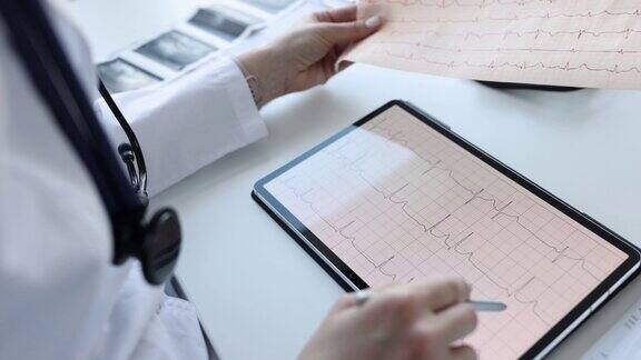 心内科医生在药片上仔细检查病人心电图