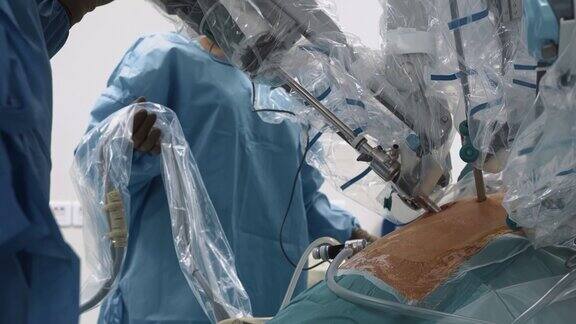 一组医生在现代诊所使用医疗机器人进行腹部手术