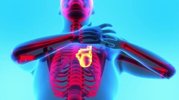 心脏病发作的迹象成年男性有疼痛x射线图像