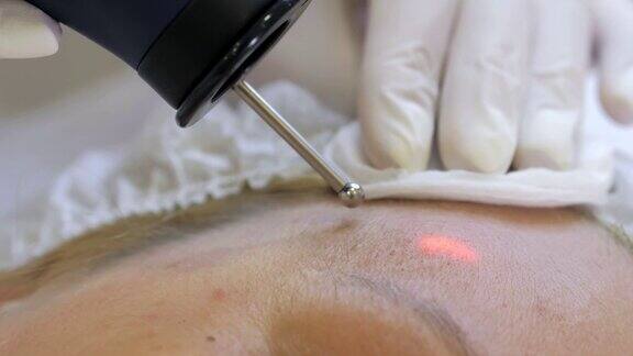 诊所里的激光手术美容师在美容医学诊所为病人进行硬件激光脱毛激光脉冲可以清洁皮肤硬件美容消除色素