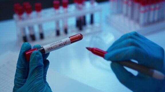 一名实验室助理在血液样本试管上标记阴性结果的特写画面中只有戴着防护手套的手