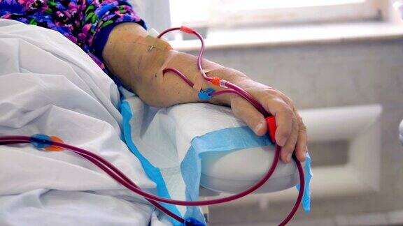 病人手臂上有连接血管的管子