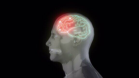医学3d动画显示一名男性头痛一个男人头痛的3d动画