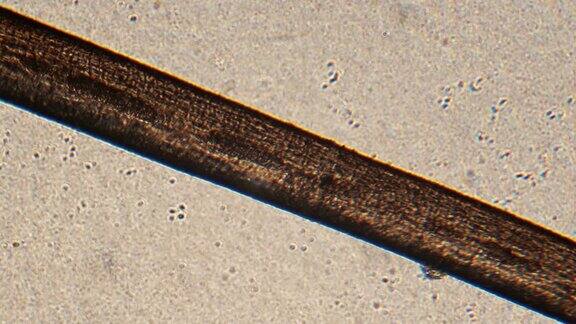 显微镜观察人类的头发(睫毛和眉毛)在显微镜下将根部和毛茎放大150倍