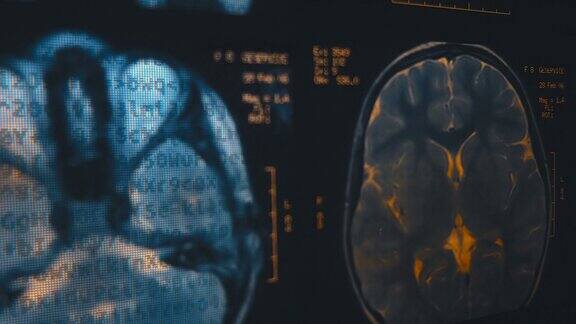 人脑的磁共振成像(mri)特写镜头宏