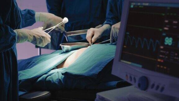 在手术室进行手术并监测生命体征