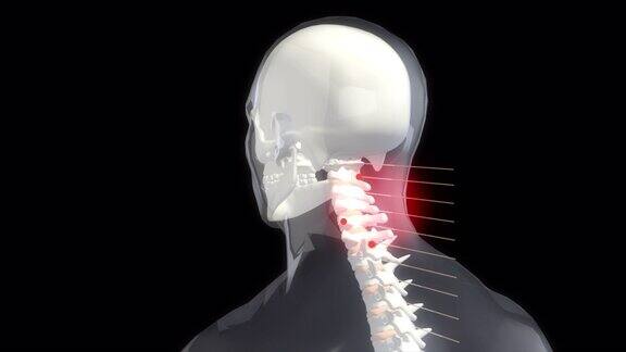 一个疼痛的脖子的3d渲染动画一名颈部剧痛的男子紧紧抓着自己的脖子医学概念3d动画